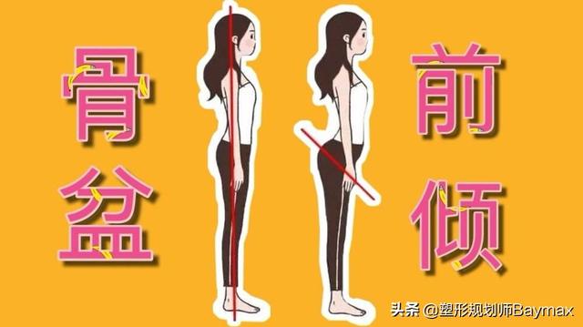 辟谣：走路外八字可以矫正O型腿？别闹了，正确的矫正需要这3步