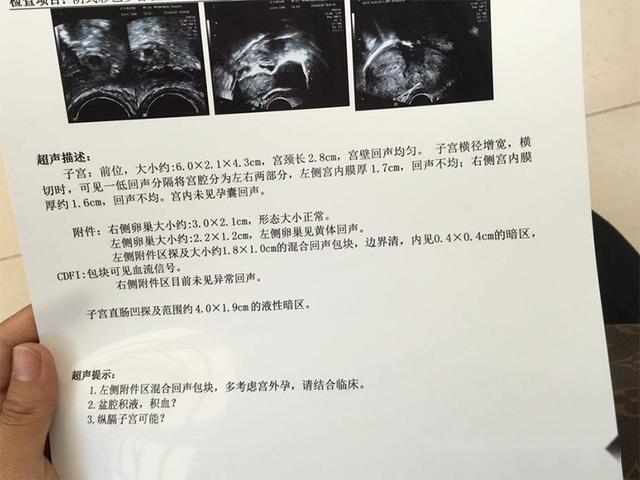 越南女子宫外孕 胎儿竟在肝脏内长了23周 最终手术失败母婴皆亡